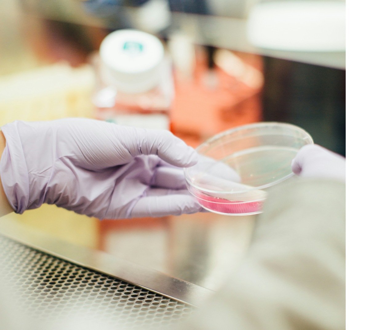 Consumentenangsten vertragen de productie van laboratoriumvlees