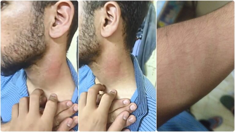 Kashmirse farmaciestudent werd aangevallen in Nagpur na geweld in Pahalgam