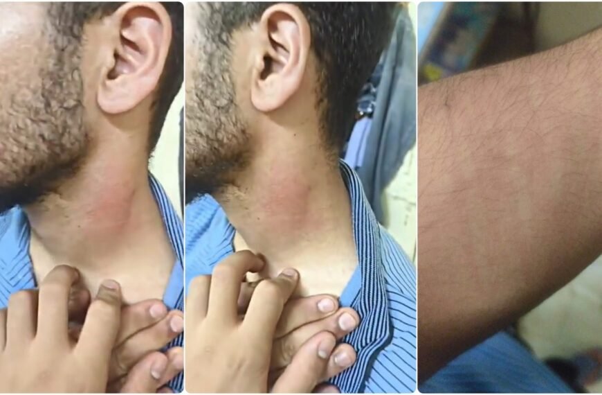 Kashmirse farmaciestudent werd aangevallen in Nagpur na geweld in Pahalgam