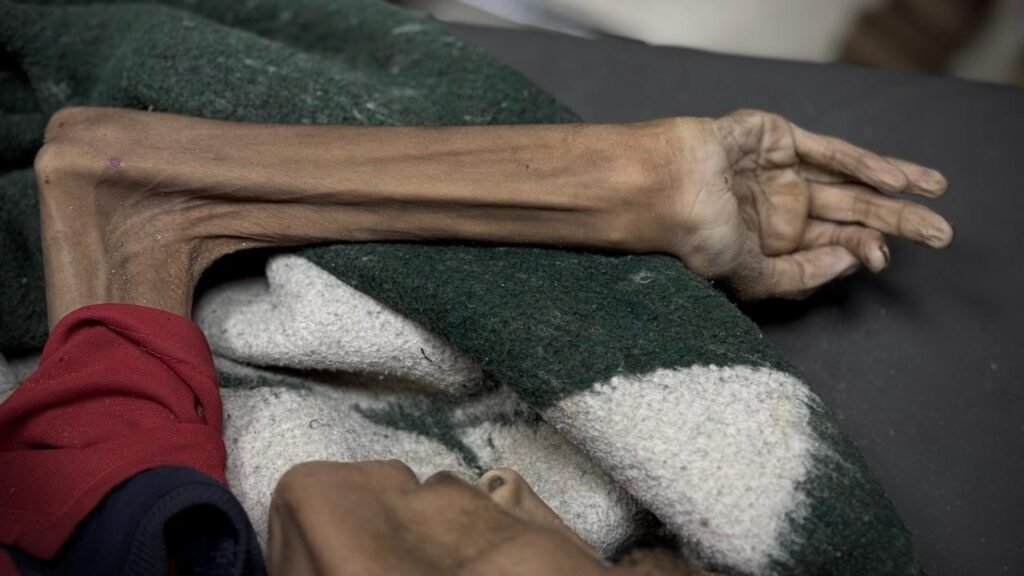 15 Palestijnen overleden aan honger door de hongersnood opgelegd door Israël