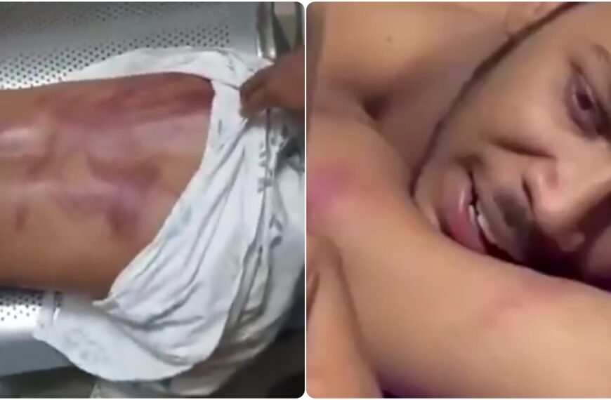 16 Yaşındaki Müslüman Çocuk, Kadına Dokununca Darp Edildi